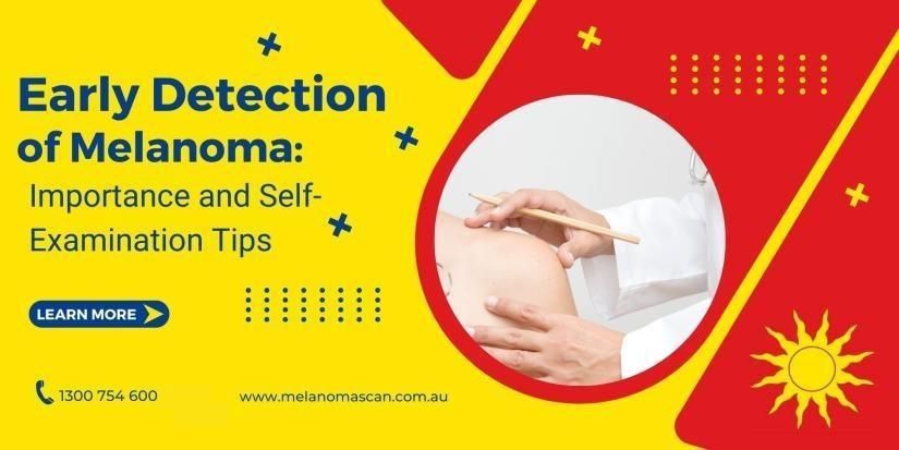 Early Detection of Melanoma
