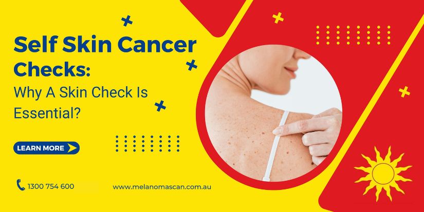Self Skin Cancer Checks: Why They're Essential