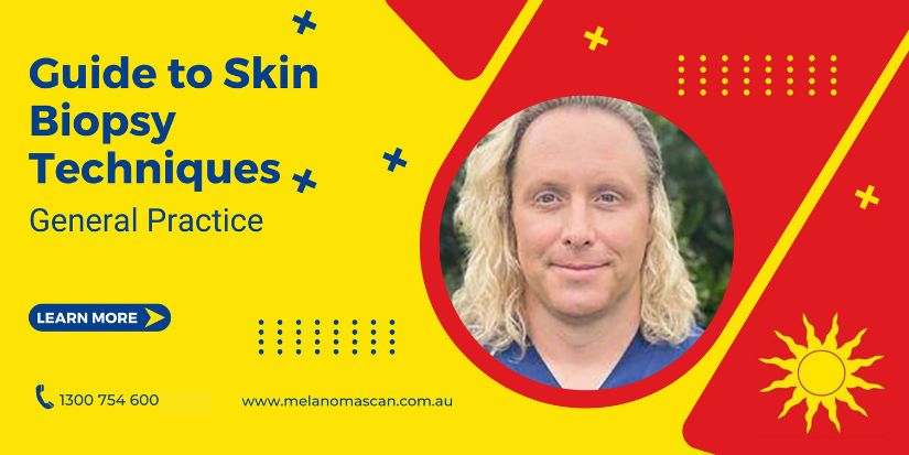 Guide to Skin Biopsy Techniques in General Practice
