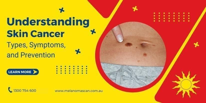 Understanding Skin Cancer