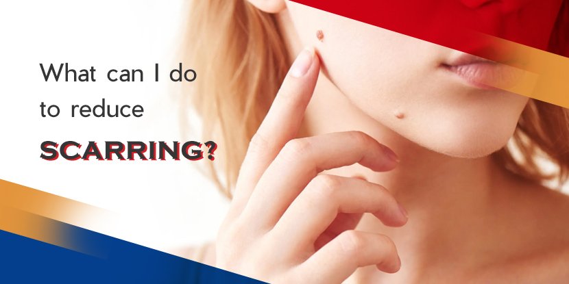 how to reduce scarring