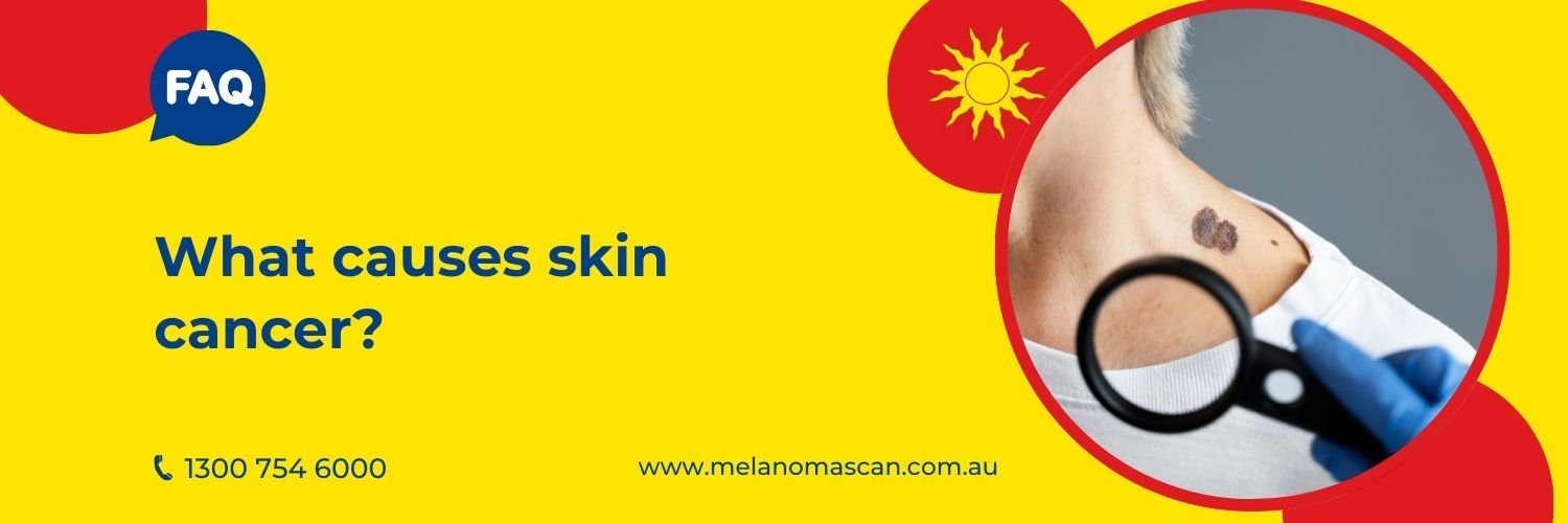 causes of skin cancer