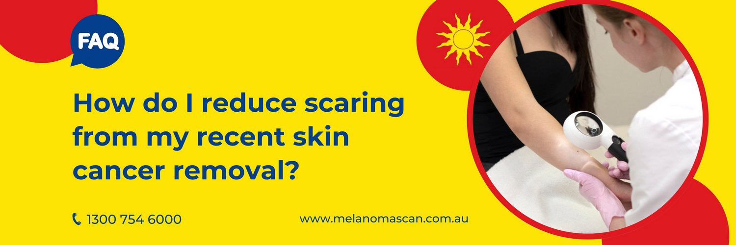 skin cancer removal