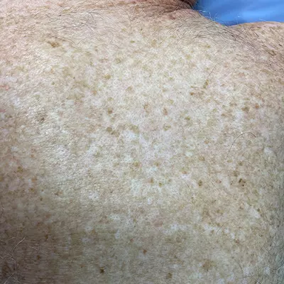 8486 Freckles Sunspots